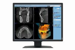 EIZO RadiForce MX217-SB computer monitor 53.3 cm [21"] 1200 x 1600 pixels UXGA LCD Black 