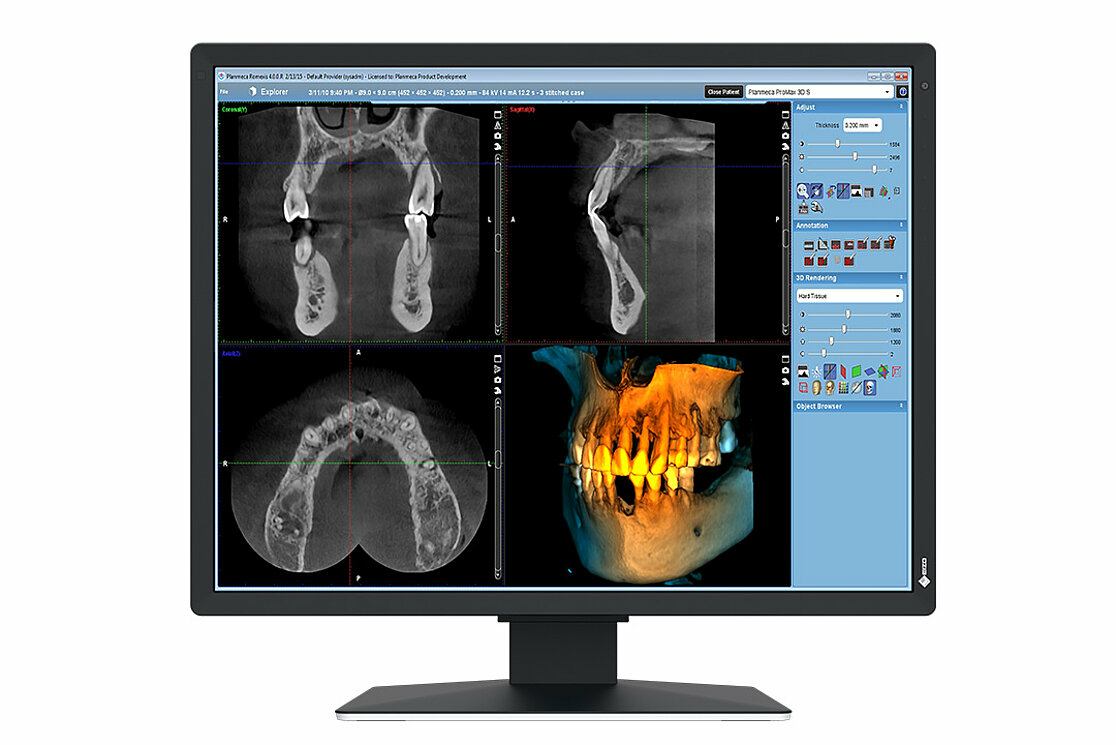 EIZO RadiForce MX217-SB computer monitor 53.3 cm [21] 1200 x 1600 pixels UXGA LCD Black (2MP EIZO RADIFORCE MX217-SB)